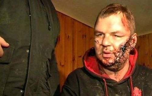 О «глазках на асфальте» и не только...