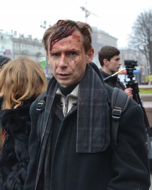 Нацисты с «евромайдана» зверски избили киевлян, вышедших на субботник Нацисты с «евромайдана» зверски избили киевлян, вышедших на субботник