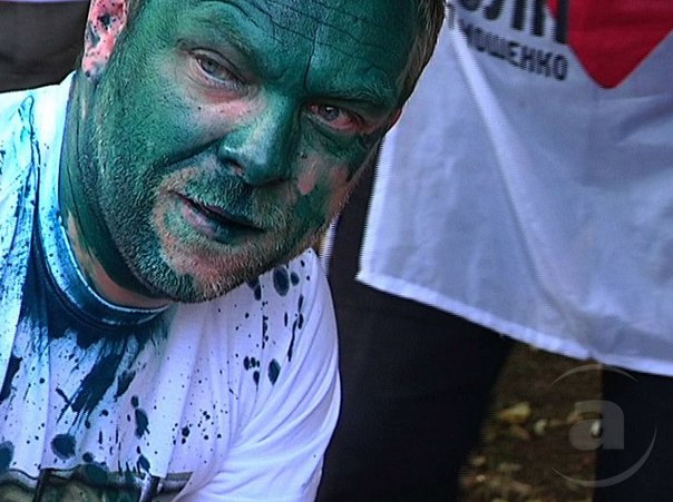 ТИПИЧНАЯ ПРОФИЛАКТИКА ЮЩЕНКОЗА! ТИПИЧНАЯ ПРОФИЛАКТИКА ЮЩЕНКОЗА!