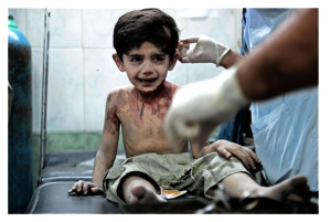 Трогательно! 3-летний мальчик, раненный смертельно: На всех вас пожалуюсь Богу, всё Ему расскажу