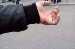 В Днепропетровске сепаратист искусал майдановца - "Свобода"