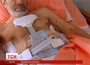 Геннадий Кернес дал первое интервью после покушения (ФОТО, ВИДЕО)