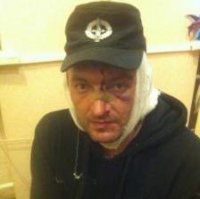 Фашизм головного мозга