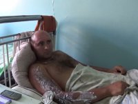 Пленный раненый сержант ВСУ