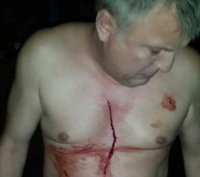 Концы в воду