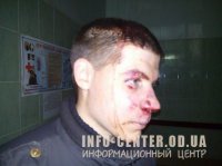 В Одессе избили карателя из "Азова"