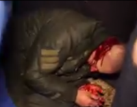 Одесса. Столкновения между Правым Сектором и администрацией казино на Дерибасовской