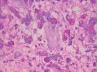 В России создан инновационный препарат против рака