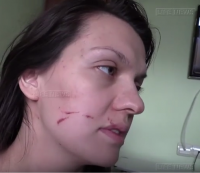 Врач элитной московской клиники избила беременную медсестру с Донбасса