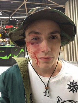 Неизвестные избили солиста группы Quest Pistols Show в центре Киева