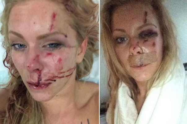 Датчанка заплатит штраф за то, что помешала беженцу себя изнасиловать Датчанка заплатит штраф за то, что помешала беженцу себя изнасиловать