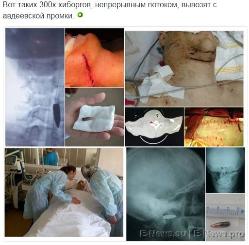 Потерь НЕТ - терять некого! Потери укрофашистов с 1 по 30 апреля (Фото)