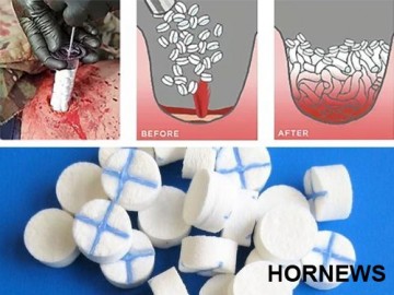 Уникальный шприц для быстрой остановки кровотечения впервые спас военнослужащего