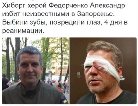 Потерь НЕТ - терять некого! Потери укрофашистов с 1 по 30 июня (Фото)