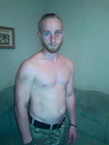 В Киеве жестоко избили боевика «Правого сектора», воевавшего в Донбассе В Киеве жестоко избили боевика «Правого сектора», воевавшего в Донбассе