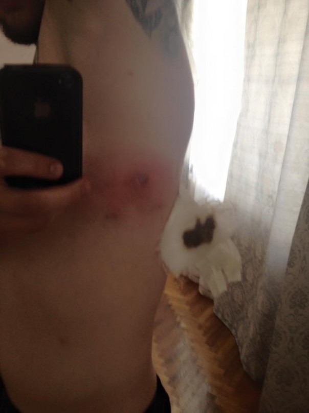 Фурункул имени Путина