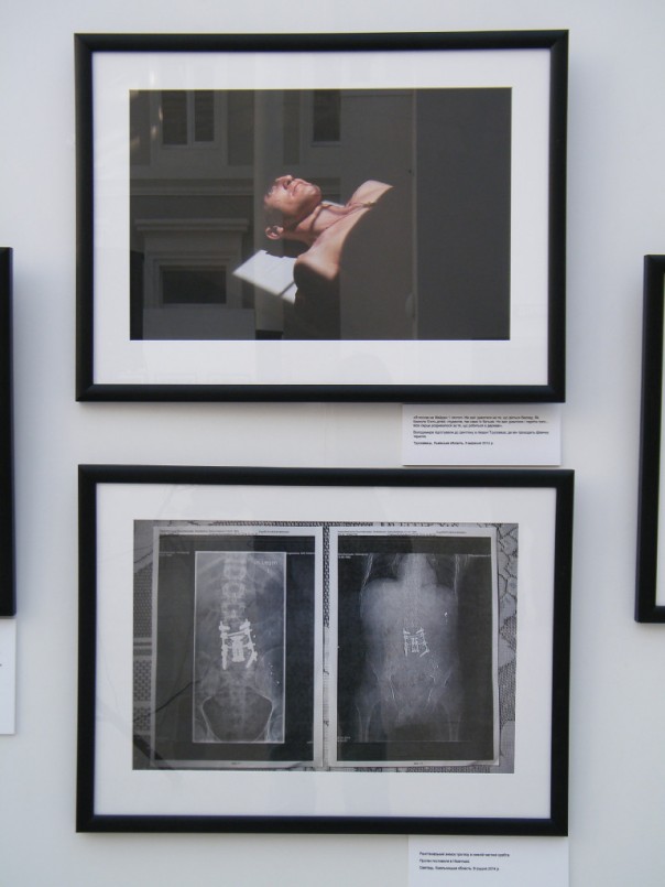 «Я назвал свой нерв Путиным – он меня мучает постоянно» – в Киеве открылась выставка фото искалеченных солдат АТО «Я назвал свой нерв Путиным – он меня мучает постоянно» – в Киеве открылась выставка фото искалеченных солдат АТО