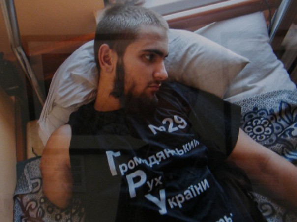 «Я назвал свой нерв Путиным – он меня мучает постоянно» – в Киеве открылась выставка фото искалеченных солдат АТО «Я назвал свой нерв Путиным – он меня мучает постоянно» – в Киеве открылась выставка фото искалеченных солдат АТО