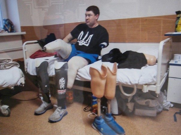 «Я назвал свой нерв Путиным – он меня мучает постоянно» – в Киеве открылась выставка фото искалеченных солдат АТО «Я назвал свой нерв Путиным – он меня мучает постоянно» – в Киеве открылась выставка фото искалеченных солдат АТО