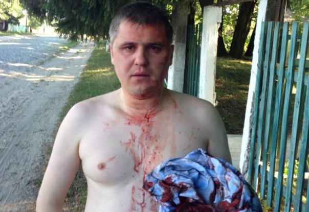 В Чернигове Азов избил коммуниста Кононовича В Чернигове Азов избил коммуниста Кононовича