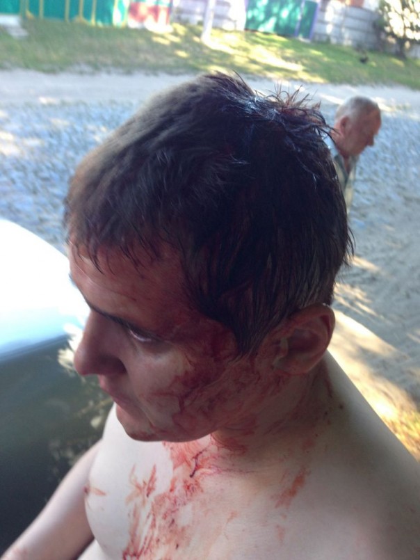 В Чернигове Азов избил коммуниста Кононовича В Чернигове Азов избил коммуниста Кононовича