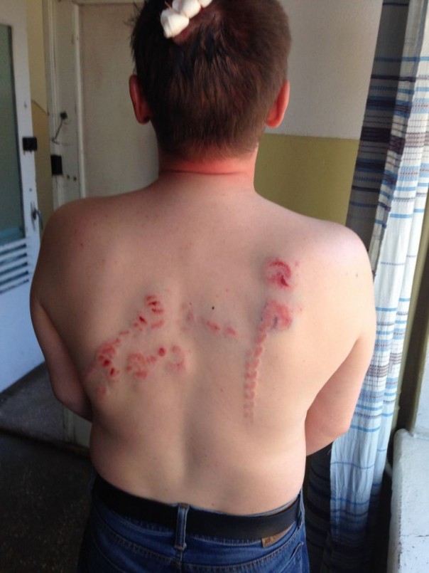 В Чернигове Азов избил коммуниста Кононовича В Чернигове Азов избил коммуниста Кононовича