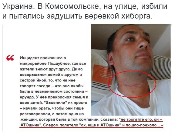 Потерь НЕТ - терять некого! Потери укрофашистов с 1 по 31 июля (Фото)