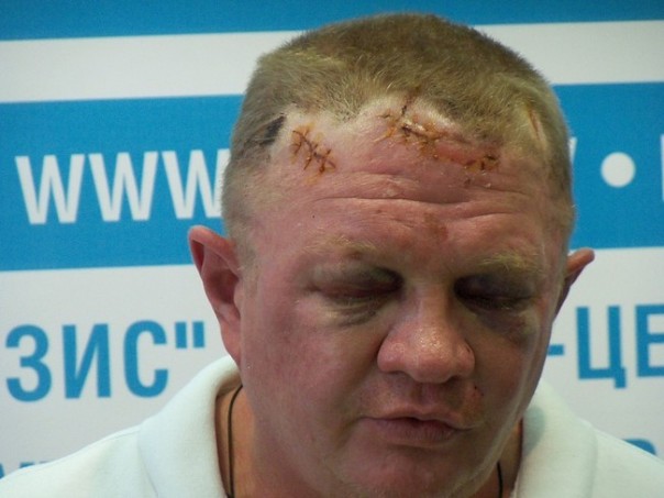 Позорный финиш майдана, или Дохлая лошадь запорожской «Самообороны» Позорный финиш майдана, или Дохлая лошадь запорожской «Самообороны»