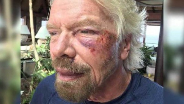 Миллиардер Брэнсон попал в аварию на велосипеде