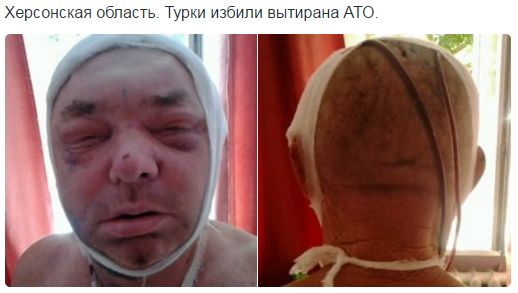 Потерь НЕТ - терять некого! Потери укрофашистов с 1 по 31 августа (Фото)