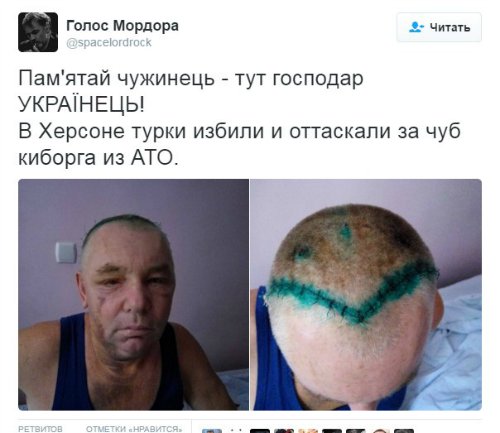 Потерь НЕТ - терять некого! Потери укрофашистов с 1 по 31 августа (Фото)