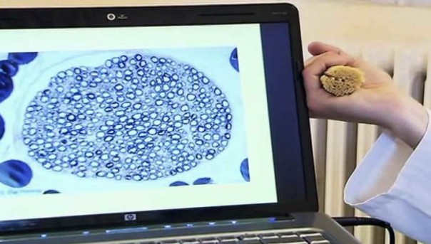 Хирург Канаверо показал мышь с пересаженной головой