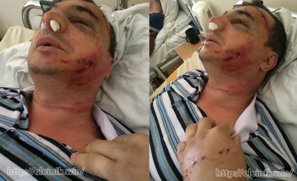 Арсен Клинчаев: я был в списке смертников Порошенко, но чудом выжил. Мы должны освободить из украинских тюрем тысячи несогласных с режимом Арсен Клинчаев: я был в списке смертников Порошенко, но чудом выжил. Мы должны освободить из украинских тюрем тысячи несогласных с режимом