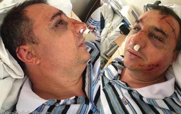 Арсен Клинчаев: я был в списке смертников Порошенко, но чудом выжил. Мы должны освободить из украинских тюрем тысячи несогласных с режимом Арсен Клинчаев: я был в списке смертников Порошенко, но чудом выжил. Мы должны освободить из украинских тюрем тысячи несогласных с режимом