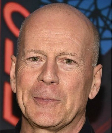 Если бы у лысых знаменитостей были волосы