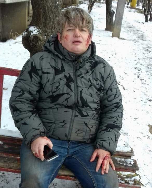 В Харькове избили «активиста» местного Евромайдана В Харькове избили «активиста» местного Евромайдана