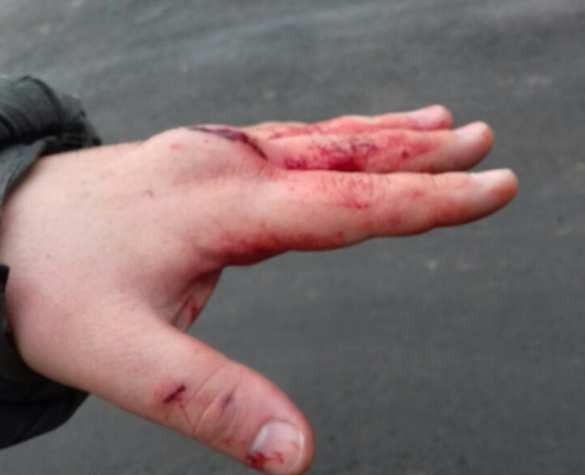 В Харькове избили «активиста» местного Евромайдана В Харькове избили «активиста» местного Евромайдана