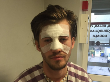 Избитый британскими военными латыш: «Подумали, что я русский и начали бить»