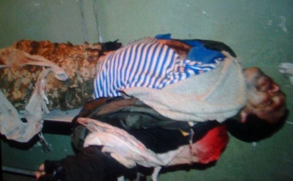 Анна Долгарева: Ликвидация мини-котла под Дебальцево. Фото 18+ Анна Долгарева: Ликвидация мини-котла под Дебальцево. Фото 18+