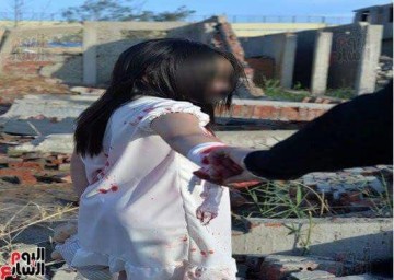 Фотографа, сделавшего фото «раненых детей Алеппо», задержали в Египте