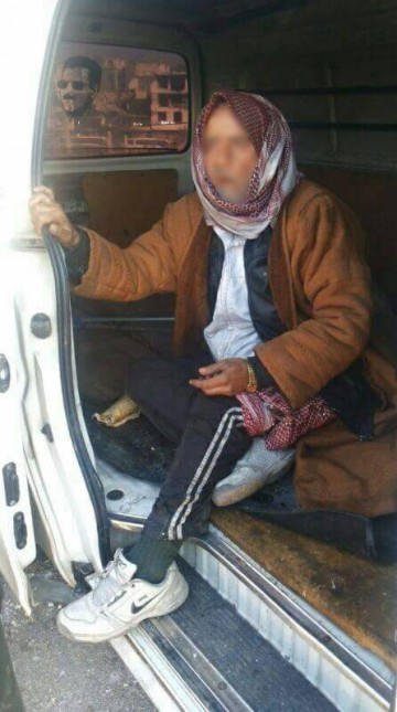 Жители Алеппо рассказали, как боевики продавали раненых на органы по 290$