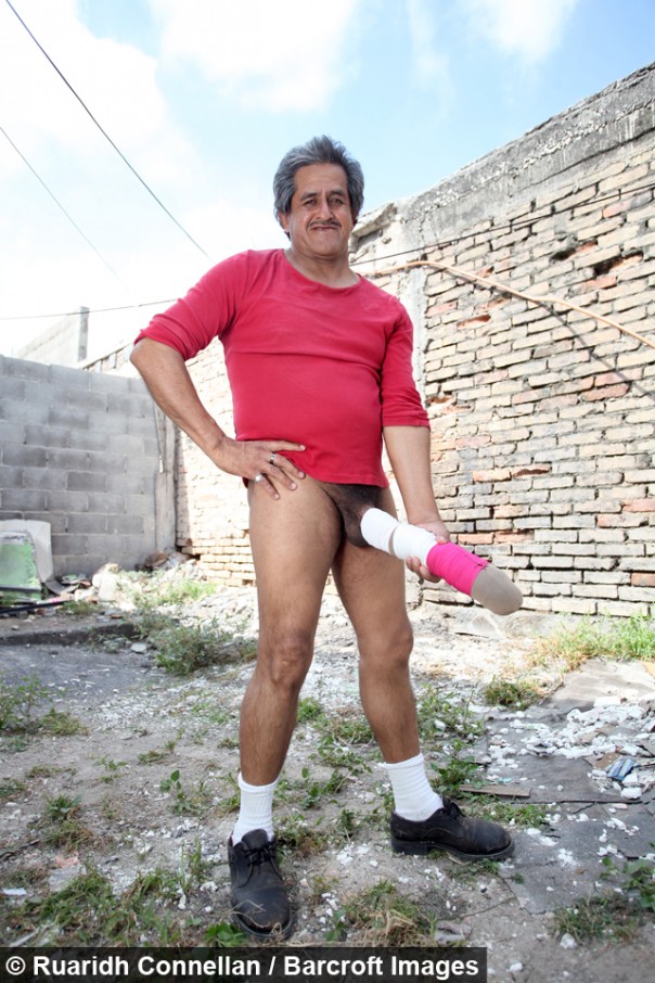 В Мексике обладателя 45-сантиметрового полового органа признали инвалидом (18+) В Мексике обладателя 45-сантиметрового полового органа признали инвалидом (18+)