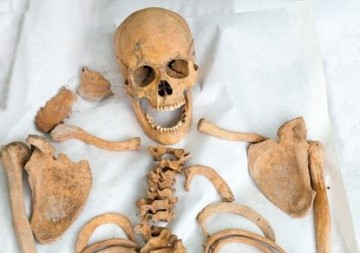 Скелет нацистского Ангела Смерти стал наглядным пособием для студентов