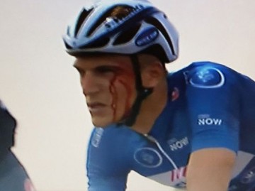 Украинского велосипедиста дисквалифицировали за то, что он разбил в кровь лицо лидеру гонки