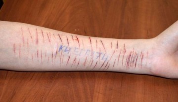 Новые "Группы смерти" в интернете: "Синие киты" провоцируют детей на самоубийство