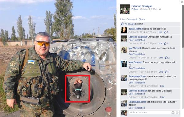 Как заскулил тот самый, каклоармянский каратель, фотографировавшийся с "ручкой сепаратиста" Как заскулил тот самый, каклоармянский каратель, фотографировавшийся с "ручкой сепаратиста"