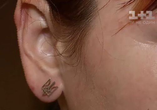 Вдову киборга избили в Днепре за украинский язык