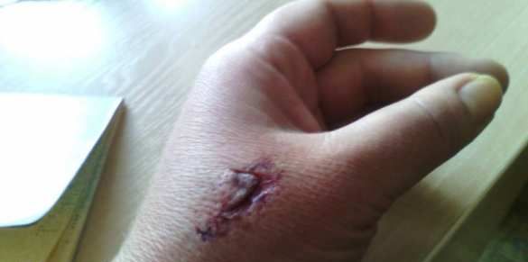 Продавец, избившая вдову карателя, рассказала подробности драки: "Назвала меня курвой и вцепилась ногтями в лицо" Продавец, избившая вдову карателя, рассказала подробности драки: "Назвала меня курвой и вцепилась ногтями в лицо"