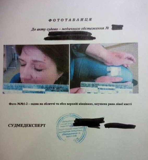 Продавец, избившая вдову карателя, рассказала подробности драки: "Назвала меня курвой и вцепилась ногтями в лицо"