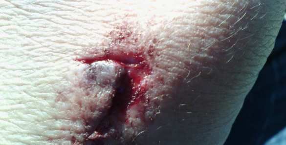 Продавец, избившая вдову карателя, рассказала подробности драки: "Назвала меня курвой и вцепилась ногтями в лицо" Продавец, избившая вдову карателя, рассказала подробности драки: "Назвала меня курвой и вцепилась ногтями в лицо"